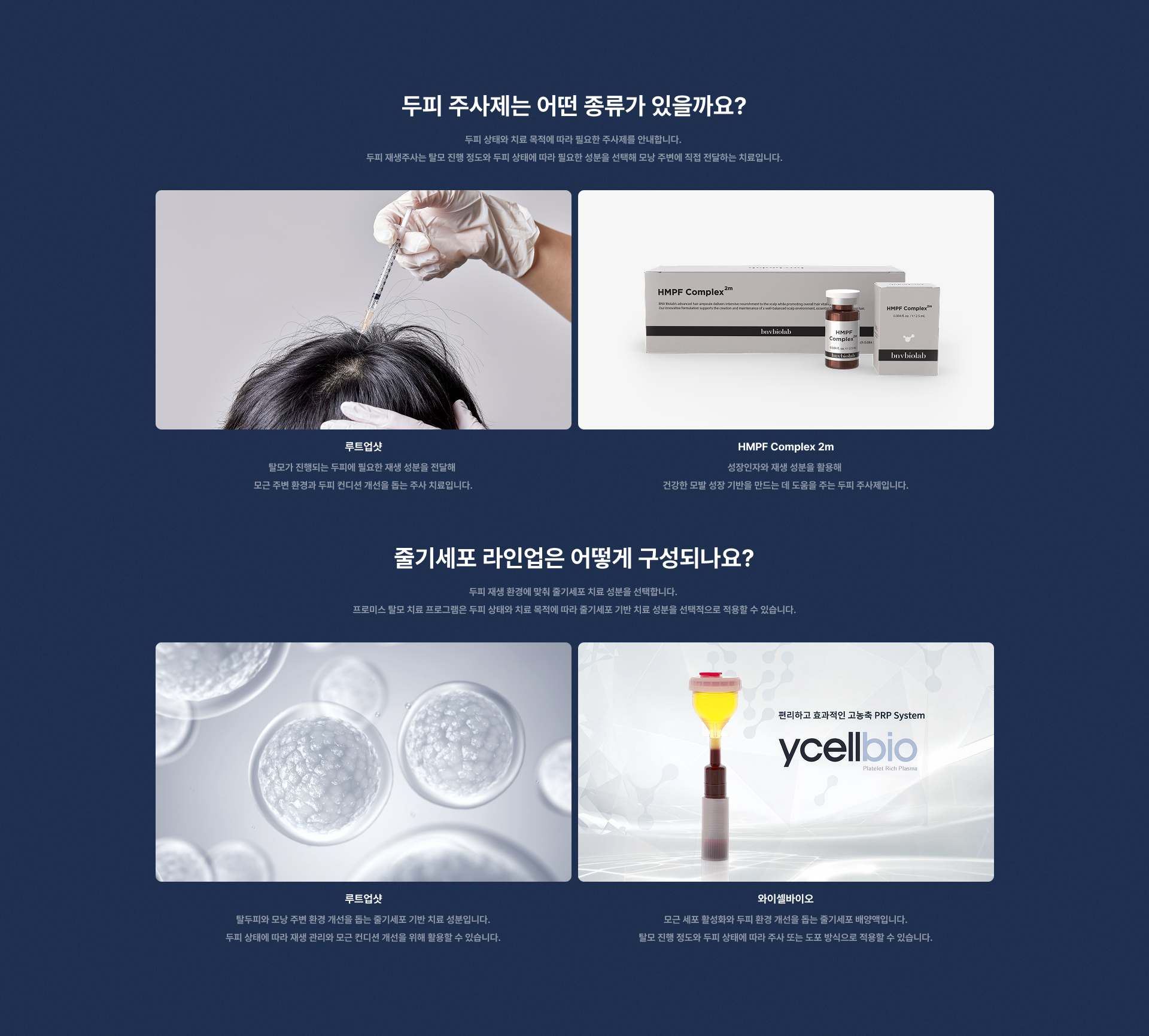 탈모치료프로그램