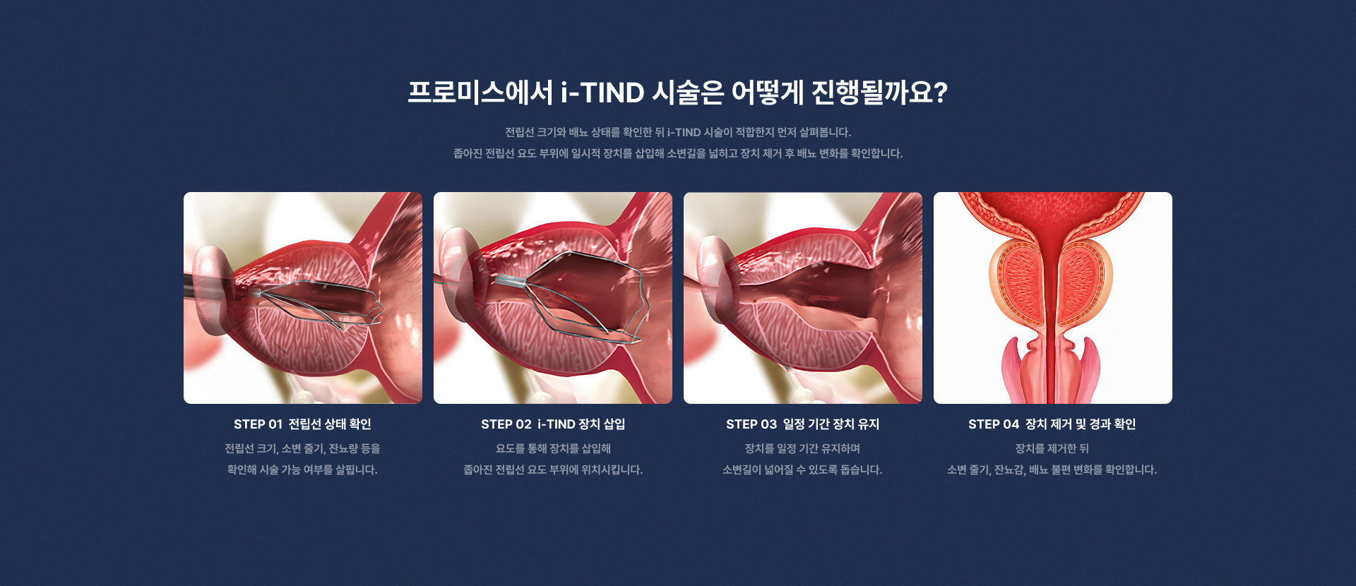 i-TIND