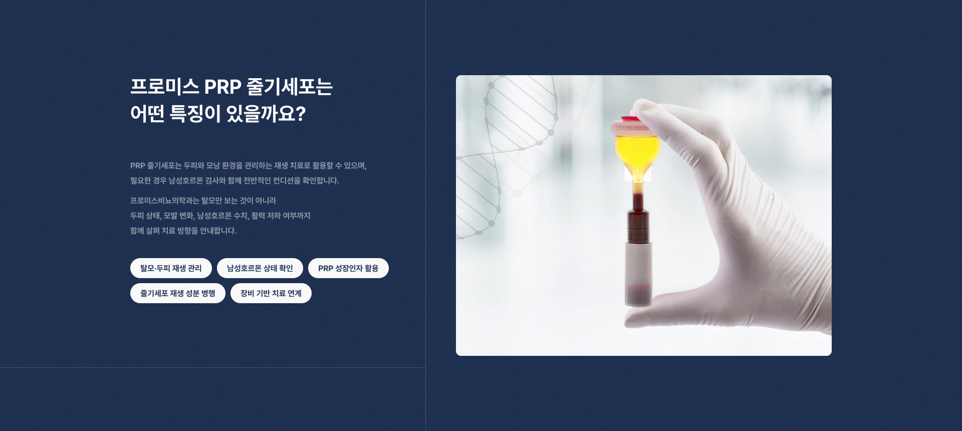 PRP 줄기세포