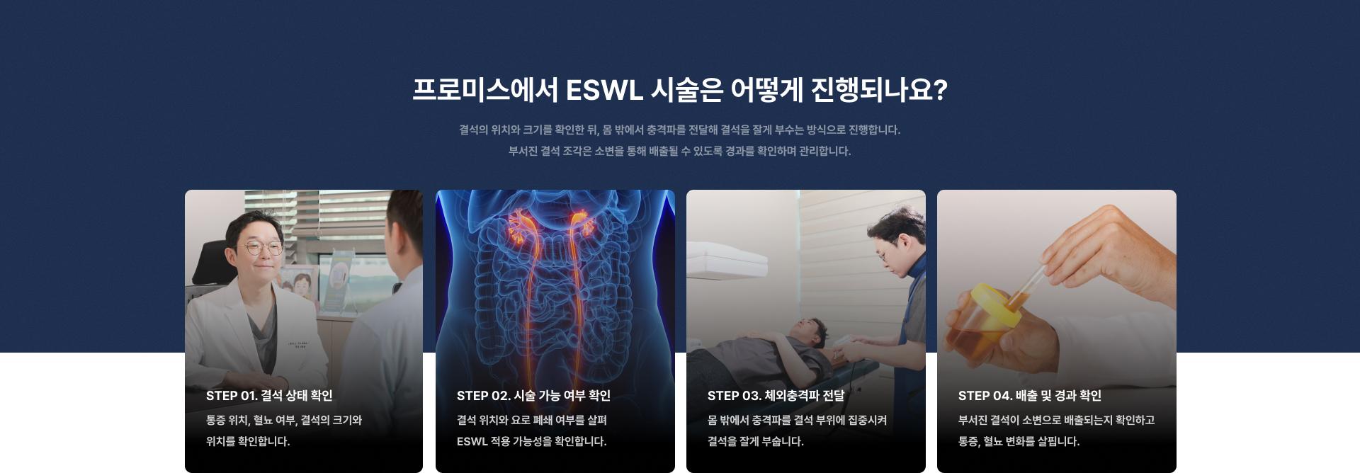 ESWL